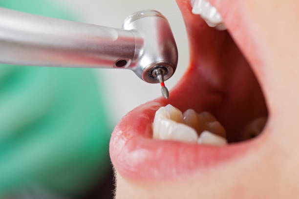 Best Emergency Gum Pain Relief  in New London, TX